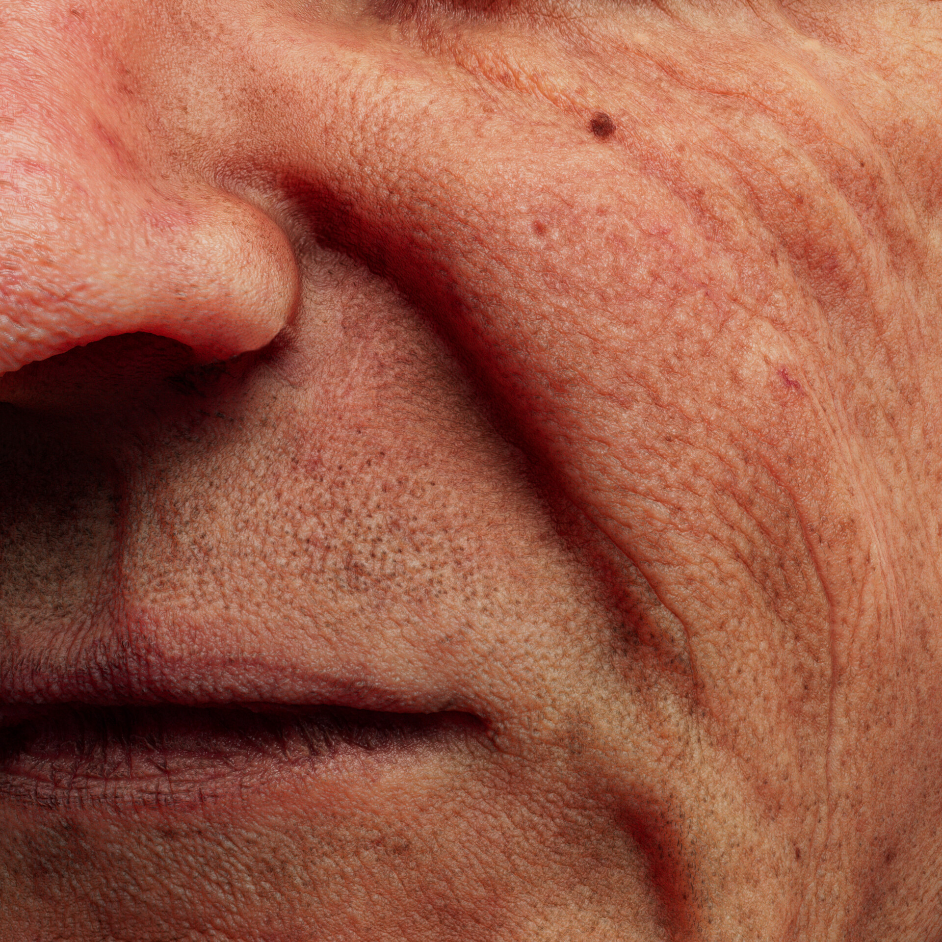 Skin detail — The Veteran